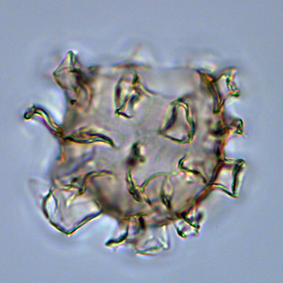 Hystrichokolpoma truncatum, U1581-20R-1W, 7-11, sl.1, E35-24, foto-e.jpg